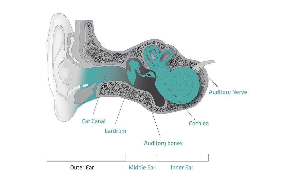 Understanding Hearing Loss and Its Modern Solutions